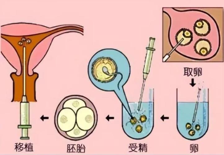 广州试管供卵婴儿_广州试管供卵婴儿:新生命的奇迹